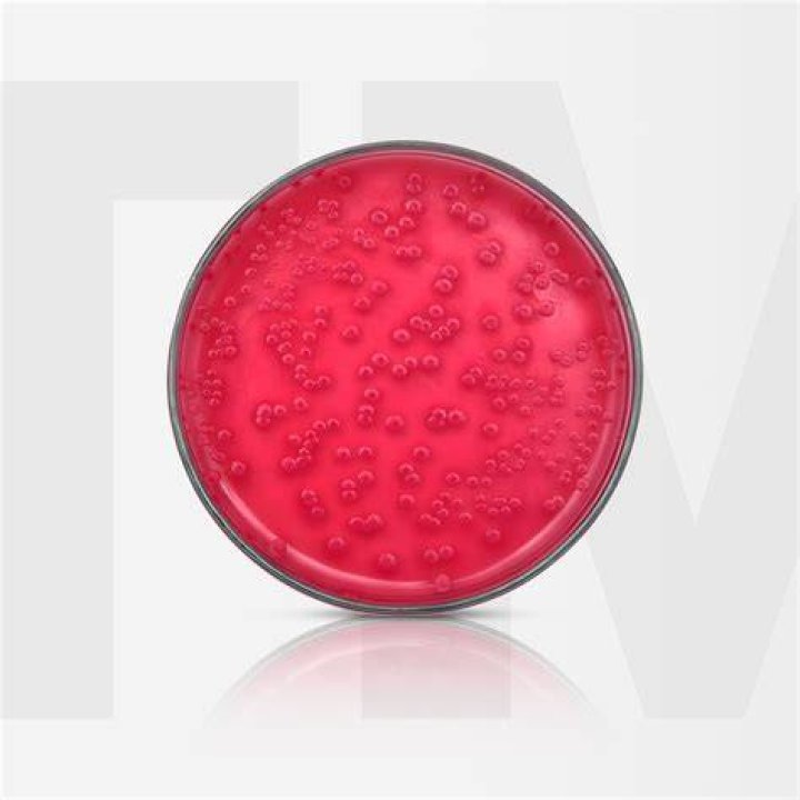 Does E coli grow on SS agar